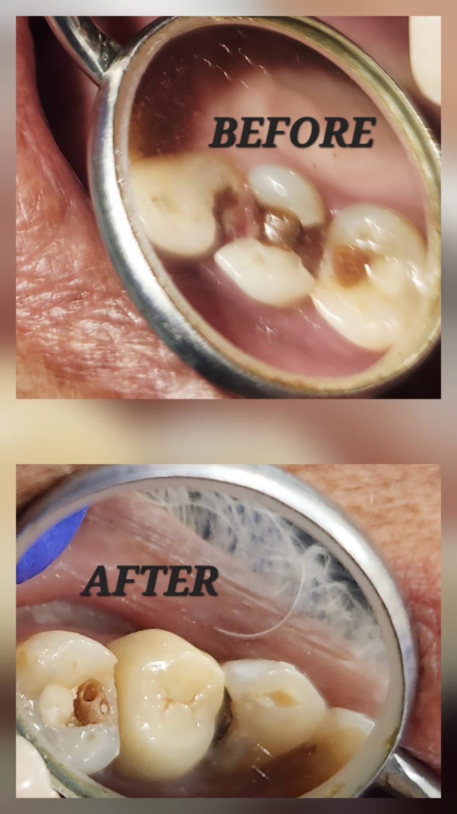 Before and after dental treatment result